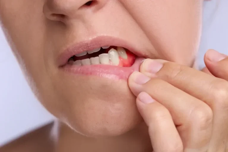 Why Small Dental Issues Should Never Be Ignored