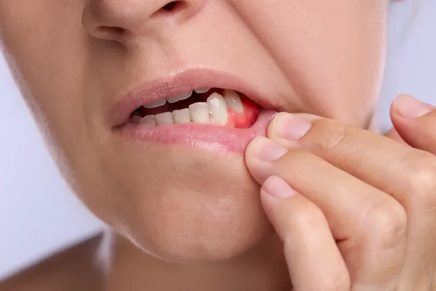 Why Small Dental Issues Should Never Be Ignored